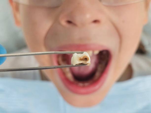 Best Pediatric Emergency Dentist in Wilton Center, CT